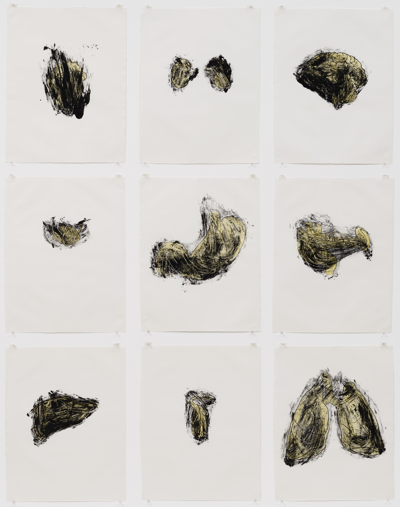 Kiki Smith. Possession Is Nine-Tenths of the Law. 1985 | MoMA